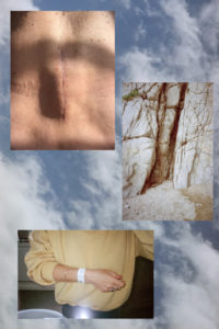 Failles©LaetitiaGesslerMontage cicatrice-breche